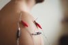 Island Acupuncture & Massage