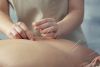 Island Acupuncture & Massage