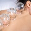 Island Acupuncture & Massage