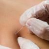 Island Acupuncture & Massage