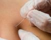Island Acupuncture & Massage