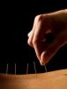 Island Acupuncture & Massage